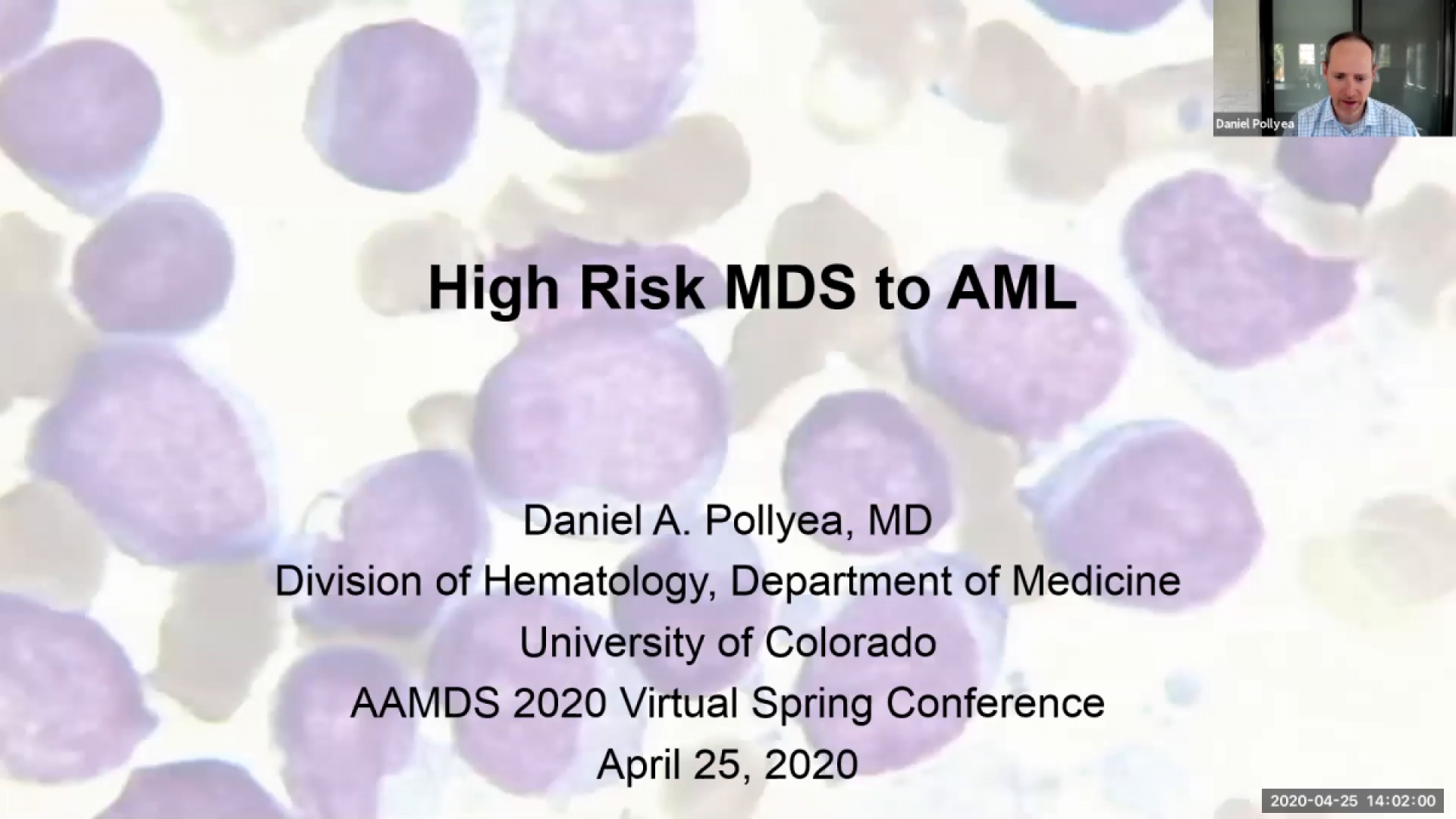 Higher Risk MDS to AML - AAMDSIF Spring Virtual Conference